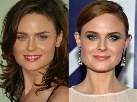 emily deschanel plastic surgery|The Transformation Of Emily Deschanel From Childhood To Bones.